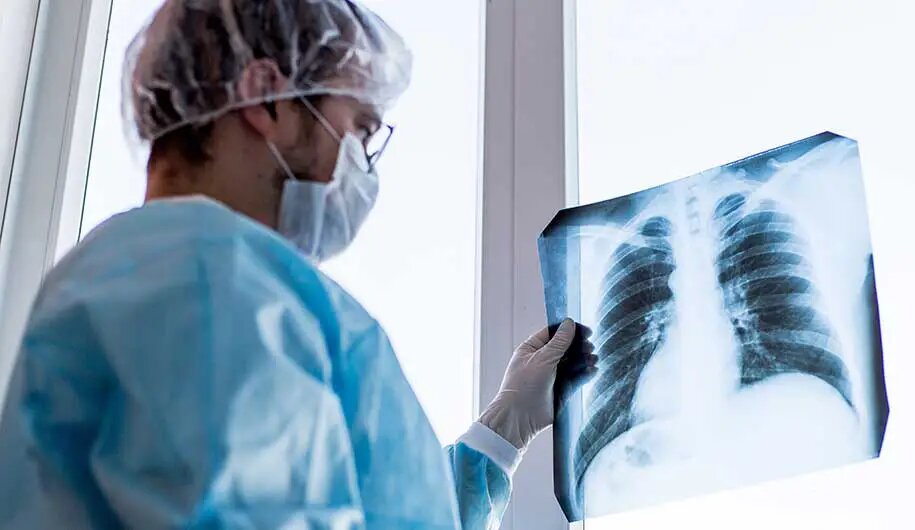 کرونای JN.۱ وارد ایران شده است؟ کرونای JN.۱ وارد ایران شده است؟