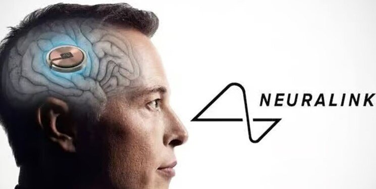 کاشت اولین تراشه روی مغز انسان کاشت اولین تراشه روی مغز انسان