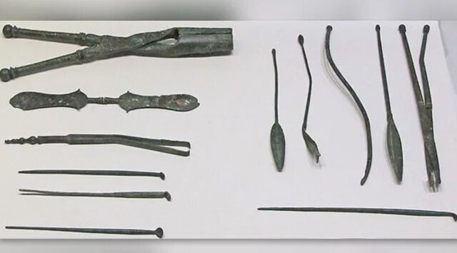 کشفی تازه درباره پزشکان باستان