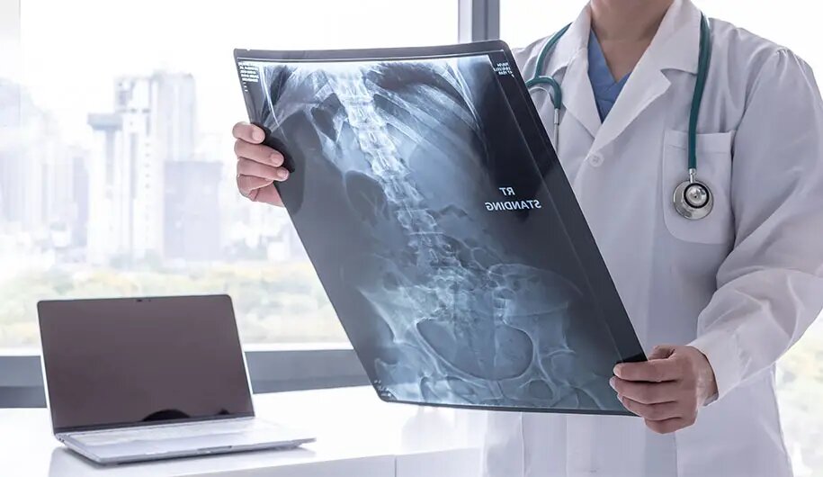 سرطانهای شایع در ایران اعلام شدند سرطانهای شایع در ایران اعلام شدند