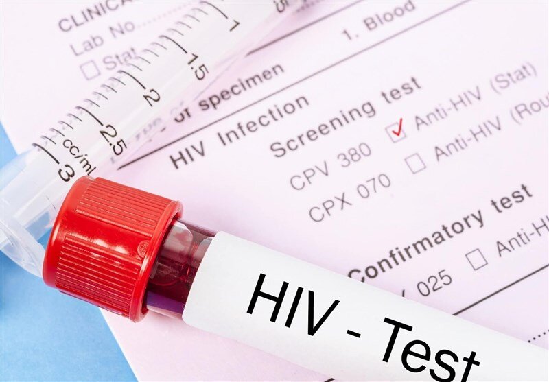 درمان محرمانه و رایگان مبتلایان به HIV درمان محرمانه و رایگان مبتلایان به HIV