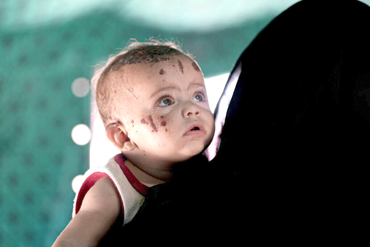 بیمارکشی بیمارکشی