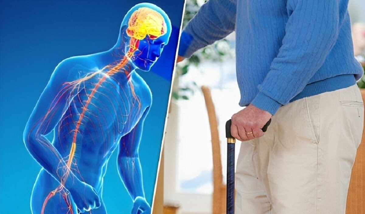 چگونه علائم پارکینسون در افراد مسن را شناسایی کنیم؟ چگونه علائم پارکینسون در افراد مسن را شناسایی کنیم؟