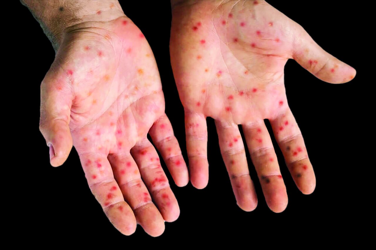 نسخه جعلی برای اصل سلامت نسخه جعلی برای اصل سلامت