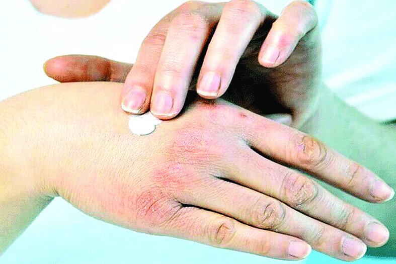 چگونه از خشکی پوست در پاییز جلوگیری کنیم؟ چگونه از خشکی پوست در پاییز جلوگیری کنیم؟