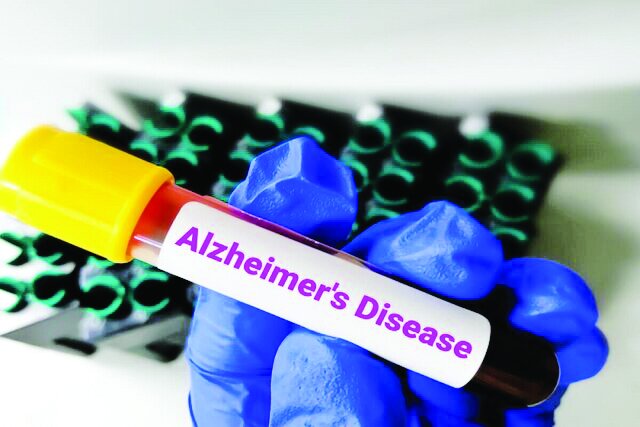 تاثیر پیاده‌روی روزانه بر مهار آلزایمر