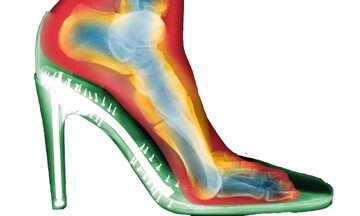 آیا واقعا کفش پاشنه‌بلند شکل پا را تغییر می‌دهد؟