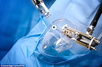 ربات و هوش مصنوعی جراح چشم شدند