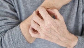 خطاهای رایج پوستی در هوای سرد