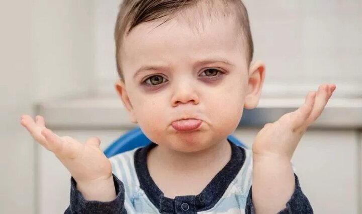 تیرگی زیر چشم کودکان نشانه چیست؛ کم‌خونی، حساسیت یا ارثی؟